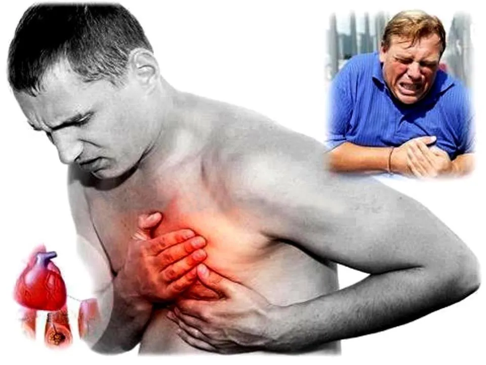 Síntomas y advertencias de ataque al corazón Síntomas y advertencias de ataque al corazón