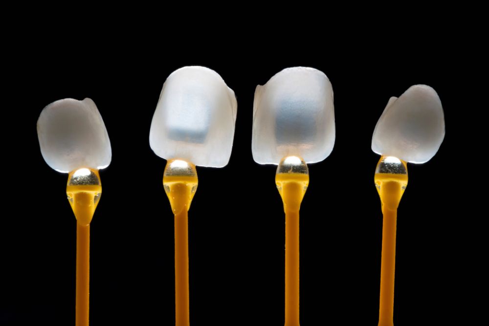 carillas dentales en porcelana carillas dentales en porcelana