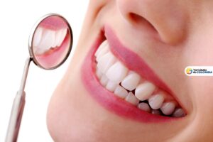 Blanqueamiento dental láser