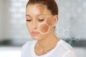 Tratamiento efectivo para eliminar manchas en la piel
