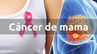 Información cáncer de mama
